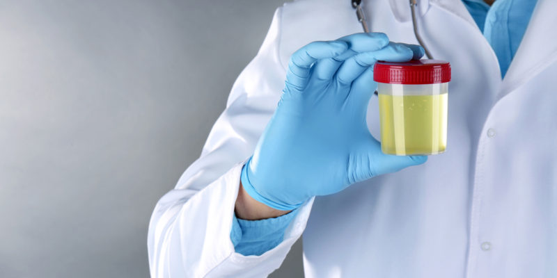Prinzipiell dürfen nicht-infektiöse untersuchte Körperflüssigkeiten bei Einhaltung aller Hygienevorschriften in die Kanalisation eingeleitet werden. (Foto: Africa Studio, Fotolia)