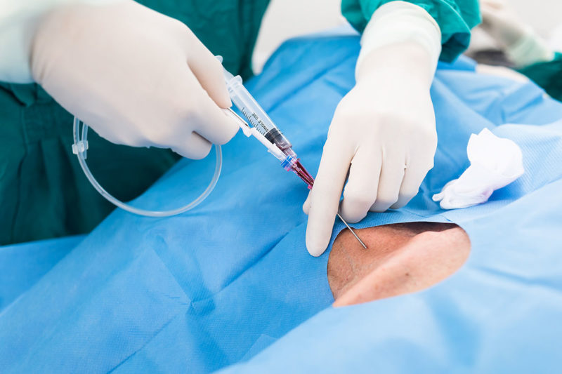 Herzkatheter-Verwertung ist eine finanziell lohnende und zudem ressourcenschonende Alternative zur Entsorgung (Foto: chanawit, AdobeStock)