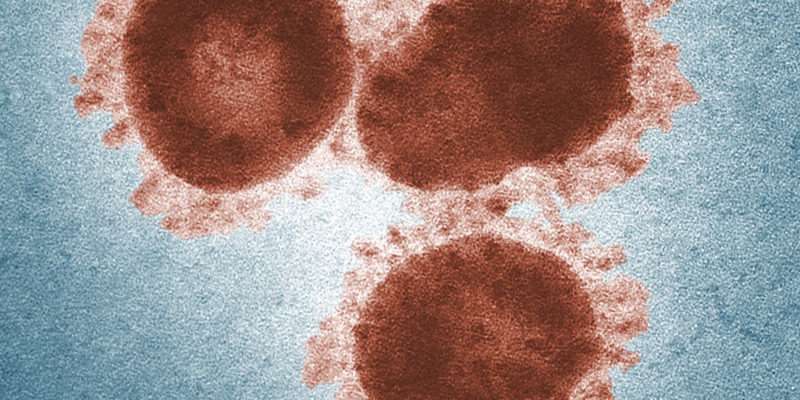 Das neuartige Coronavirus ist bislang wenig erforscht (Foto: cdc / Dr. Fred Murphy & Sylvia Whitfield)