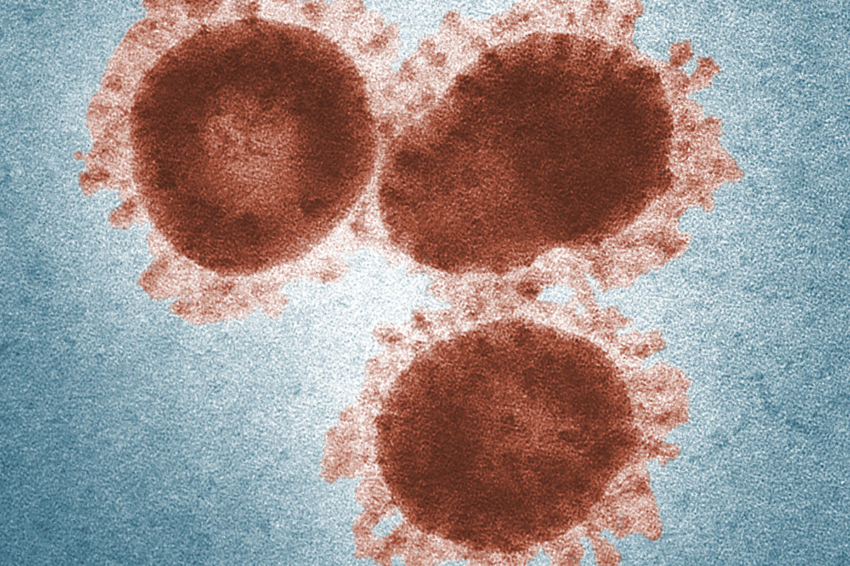 Das neuartige Coronavirus ist bislang wenig erforscht (Foto: cdc / Dr. Fred Murphy & Sylvia Whitfield)