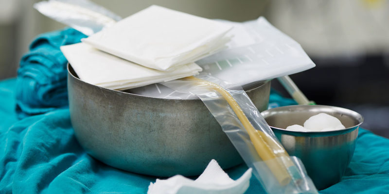 Verschiedene Abfallschlüssel können bei der Entsorgung von Drainagen Anwendung finden (Foto: klavdiyav, AdobeStock)