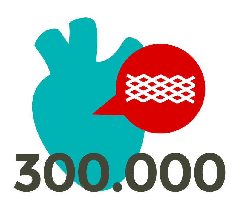 Über 300.000 Stents-Implantate pro Jahr in Deutschland