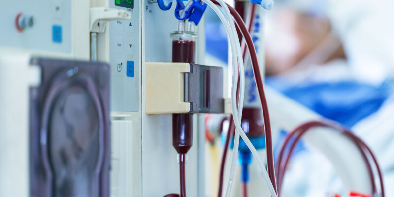 Bei der Dialyse fallen neben den obligatorischen Verpackungsmaterialien auch Abfälle wie Dialysatoren und Schlauchsysteme an (Foto: saengsuriya13, AdobeStock)