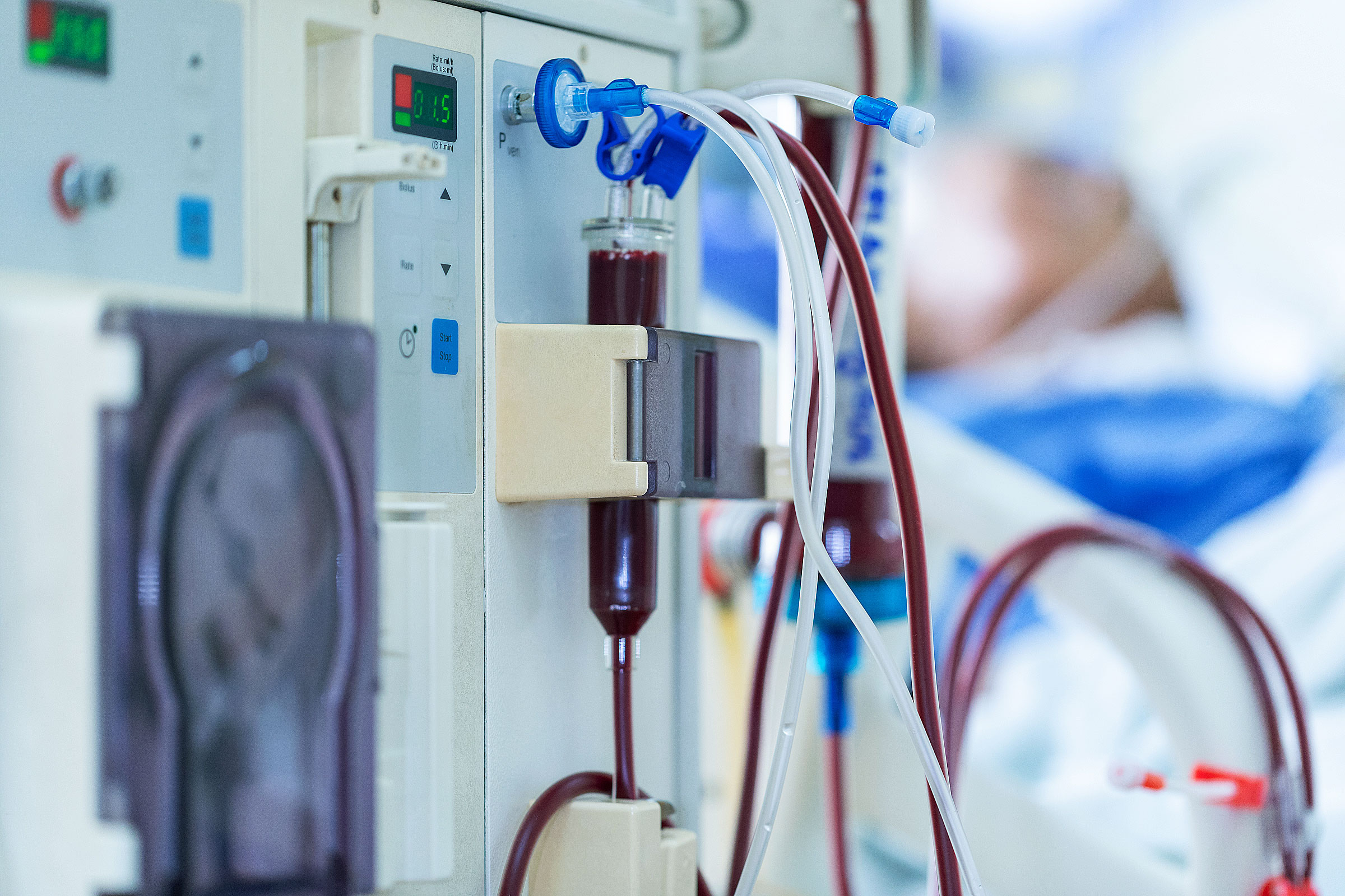 Bei der Dialyse fallen neben den obligatorischen Verpackungsmaterialien auch Abfälle wie Dialysatoren und Schlauchsysteme an (Foto: saengsuriya13, AdobeStock)