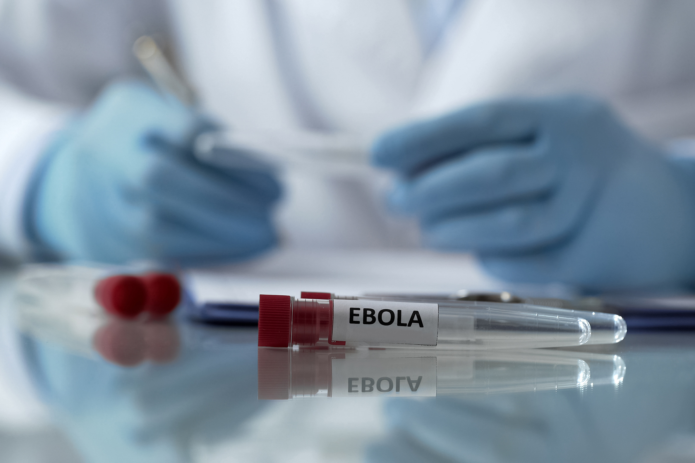 Mit Ebola, Marburg etc. belastete Abfälle richtig verpacken (Foto: Motortion, iStock)