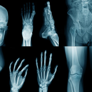 Röntgenbilder enthalten nicht nur sensible Daten, sondern auch wertvolle Rohstoffe. (Foto: angkhan, iStock)