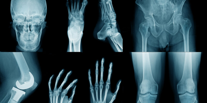 Röntgenbilder enthalten nicht nur sensible Daten, sondern auch wertvolle Rohstoffe. (Foto: angkhan, iStock)