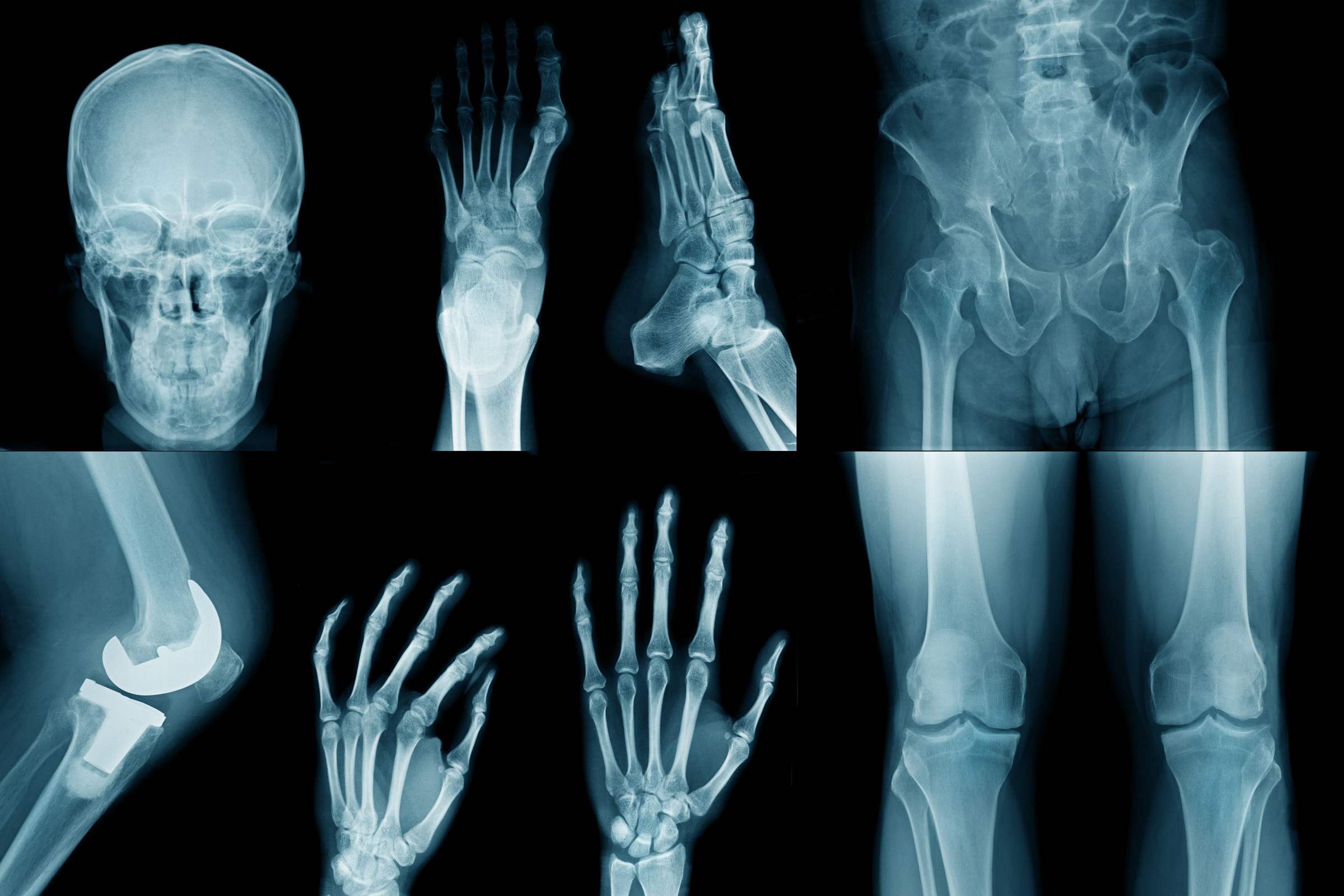 Röntgenbilder enthalten nicht nur sensible Daten, sondern auch wertvolle Rohstoffe. (Foto: angkhan, iStock)
