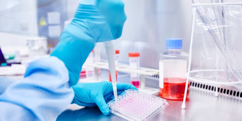 Laborsituation: Probe werden mit Pipette in eine Untersuchungsform gegeben. (Foto: Mike)