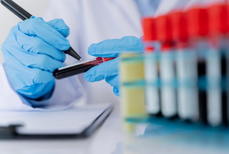 Untersuchung von Blutproben in Labor (Bildrechte: jittawit.21)